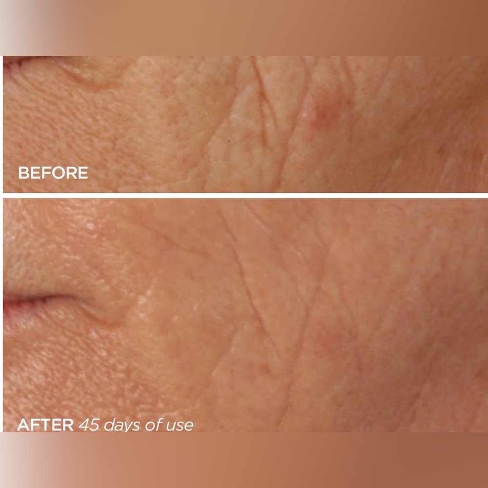 BeautyBio R45 The Reversal Skincare Set - White, Pink, Cream - Picture 9 of 10